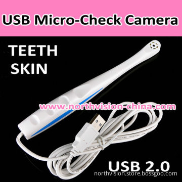 1.5m USB Portable Best Dental Video Cameras